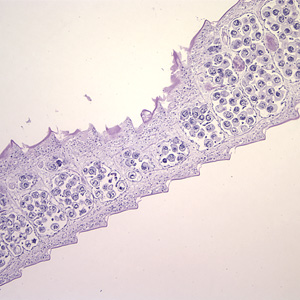 Cross-sections of mature proglottids of H. nana stained with hematoxylin and eosin (H&E), taken at 100x. Note the craspedote (overlapping) proglottids. Adapted from CDC