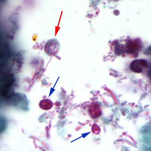 Cryptosporidium sp. oocyst stained with trichrome. Oocysts may be detected, but should not be confirmed by this method. Trichrome staining is inadequate for a definite diagnosis because oocysts will appear unstained. Here the Cryptosporidium oocyst is represented by a red arrow; the blue arrows represent yeast. Adapted from CDC