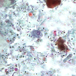 Cyst of R. intestinalis in a stool specimen, stained with trichrome. Adapted from CDC