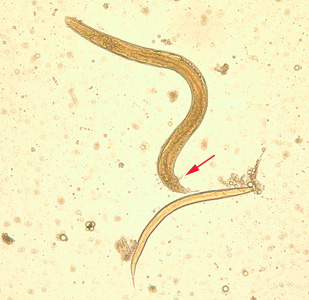 Free living adult male S. stercoralis, showing a spicule (red arrow). A smaller, rhabditiform larva lies adjacent to the adult male. Adapted from CDC