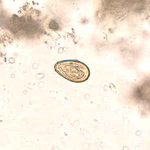 Egg of O. viverrini in an unstained wet mount of concentrated stool. Image taken at 400x magnification Adapted from CDC