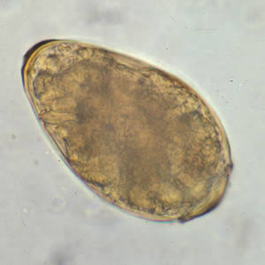 Egg of P. westermani in an unstained wet mount. Adapted from CDC
