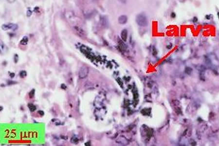 A. costaricensis first stage (L1) larva in intestinal tissue stained with H&E Adapted from CDC