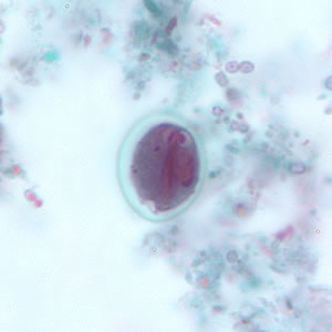 G. duodenalis cyst stained with trichrome. Sometimes the cytoplasm of the cyst may retract from the cell wall. Adapted from CDC