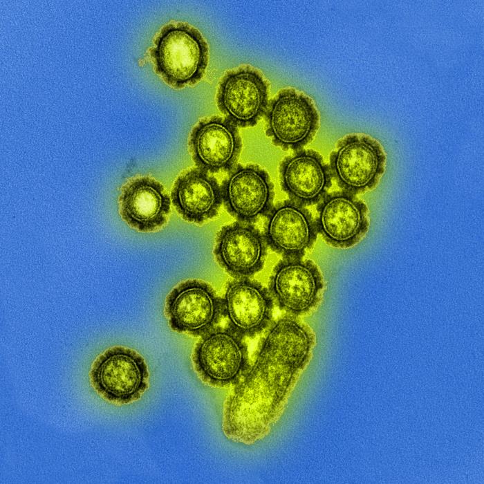 Produced by the National Institute of Allergy and Infectious Diseases (NIAID), this digitally-colorized transmission electron micrograph (TEM) depicts numbers of H1N1 influenza virus particles. Surface proteins located on the surface of the virus particles are shown in black. Image obtained from Public Health Image Library (PHIL).
