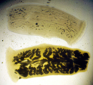 Mature proglottid of T. solium, stained with India ink. Note the number of primary uterine branches (<13) in the lower specimen. Adapted from CDC