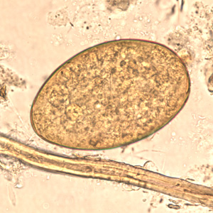 Egg of F. buski in a unstained wet mount. Adapted from CDC