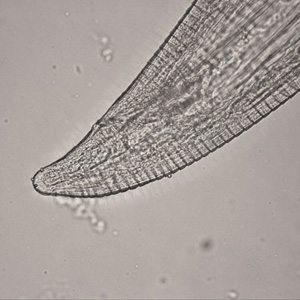 Posterior end of a female Thelazia sp. Adapted from CDC