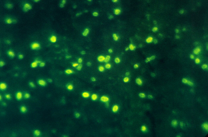 Photomicrograph of Haemophilus influenzae using immunofluorescence. From Public Health Image Library (PHIL). [8]
