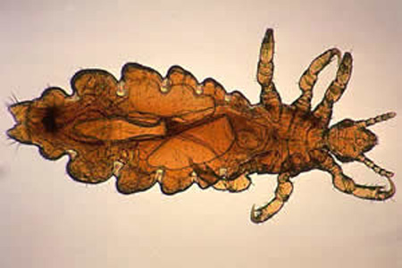 Adult female of P. humans capitis. In this specimen, eggs can be observed in the abdomen. Adapted from CDC