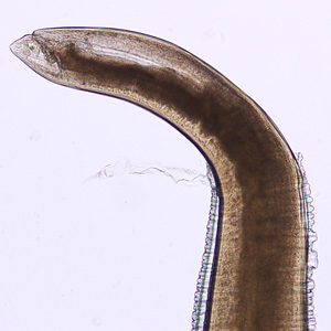 Posterior end of Pseudoterranova sp. Image taken at 200x magnification. Adapted from CDC