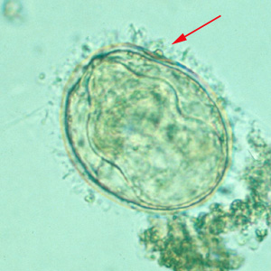 Egg of S. mekongi. Note the inconspicuous spine (red arrow). Adapted from CDC