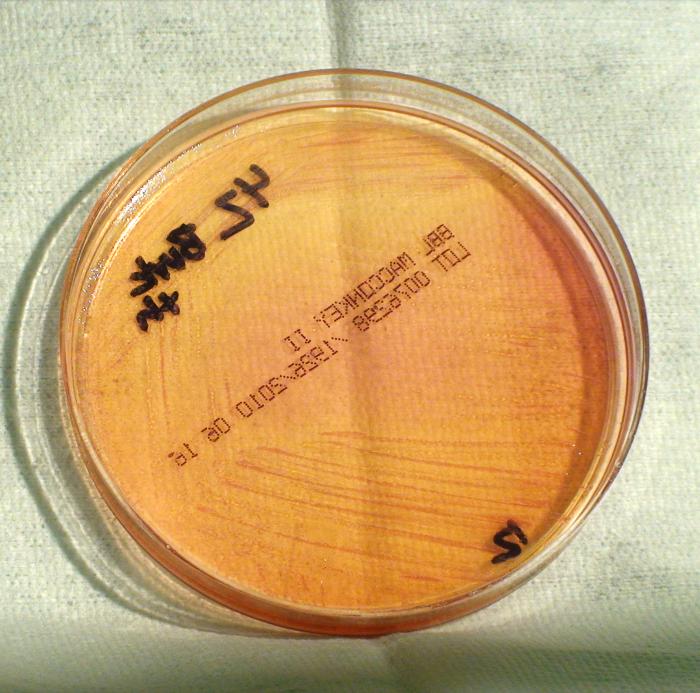 Gram-negative Burkholderia thailandensis bacteria, which was grown on a medium of MacConkey agar 24hrs. From Public Health Image Library (PHIL). [5]
