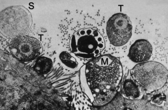TEM reveals ultrastructural pathology seen in a tissue sample in a case of cryptosporidiosis. From Public Health Image Library (PHIL). [1]