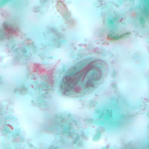File:Giardia cyst tric6.jpg