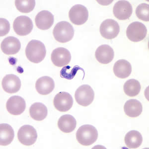 T. cruzi trypomastigote in a thin blood smear stained with Giemsa. Adapted from CDC