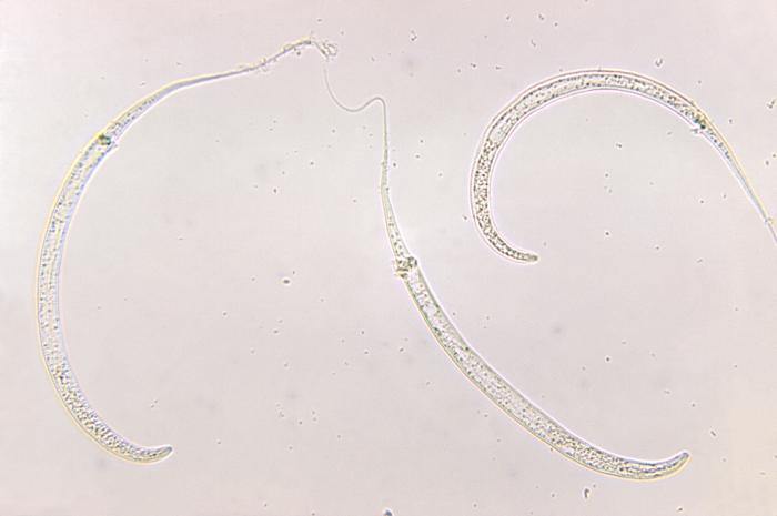 Three Guinea worms, Dracunculiasis medinensis (125X mag). From Public Health Image Library (PHIL). [8]
