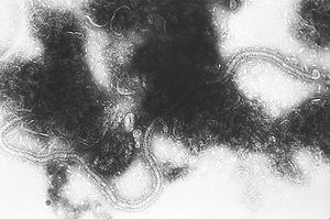 TEM image of Human respiratory syncytial virus