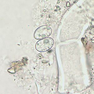 Sporulated oocyst of Sarcocystis sp. in an unstained wet mount, magnification 400x. Adapted from CDC