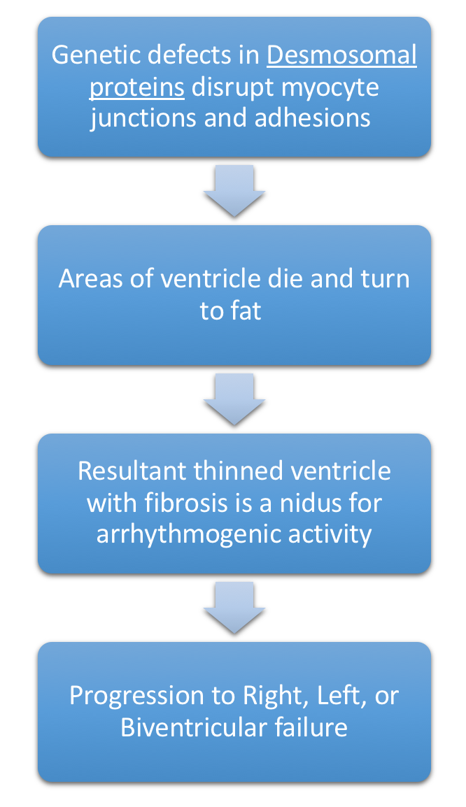 Figure 7. Pathophysiology of Arrhythmogenic Ventricular Dysplasia or Arrhythmogenic Ventricular Cardiomyopathy. Patients often report in Ventricular Tachycardia. Right ventricle is most commonly affected.