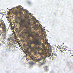 Unfertilized egg of A. lumbricoides in an unstained wet mount, 200x magnification. Adapted from CDC