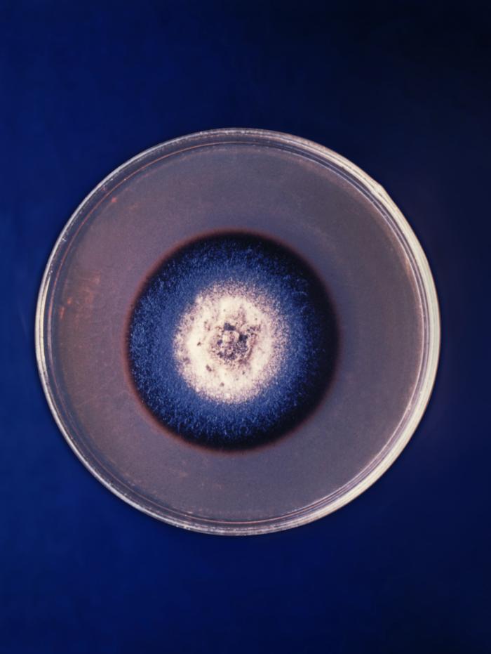 This is a plate culture of Piedraia hortae, strain A272. From Public Health Image Library (PHIL). [3]