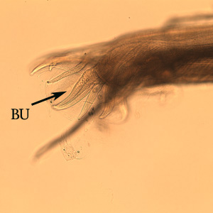 Posterior end of a male Oesophagostomum sp., Note the bursa (BU).