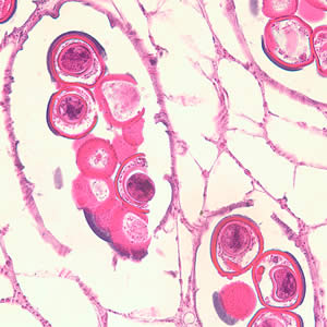 Cross-section of a D. caninum proglottid stained with H&E. Image taken at 400x magnification Adapted from CDC
