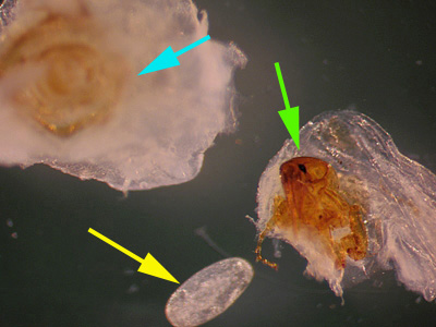 Tunga penetrans removed from a lesion on the bottom of the foot of a patient who traveled to Africa. The bulk of the lesion and the posterior part of the flea are marked with a blue arrow. The anterior end of the flea, showing the head, mouthparts and forelegs, is marked with a green arrow. Note the lack of pronotal and genal combs. A single egg (yellow arrow), is also shown. Adapted from CDC