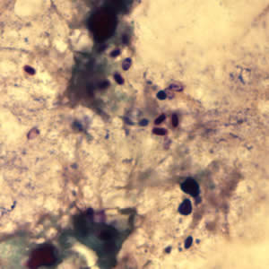 File:Ecuniculi spores gramchromo3 2012.jpg