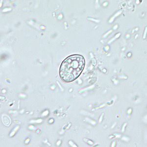 Individual sporocyst of Sarcocystis sp. in an unstained wet mount, magnification 400x. Adapted from CDC
