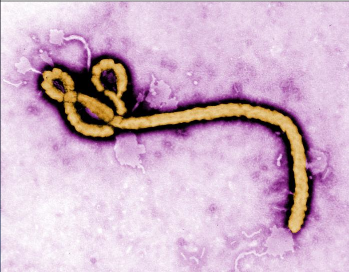 This transmission electron micrograph (TEM) demonstrates the ultrastructural morphology displayed by an Ebola virus. Source: CDC microbiologist Frederick A. Murphy.Adapted from Public Health Image Library (PHIL), Centers for Disease Control and Prevention.[8]