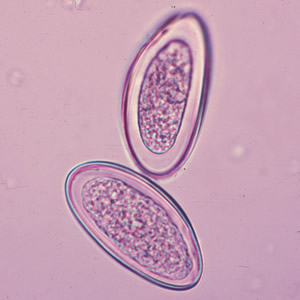 Eggs of E. vermicularis in a wet mount. Adapted from CDC