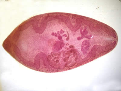 Higher magnification of the adult fluke seen in Figure 1. Adapted from CDC