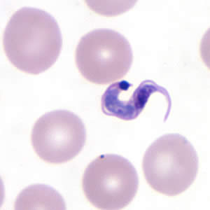 Higher magnification of Figure 3, T. cruzi. Adapted from CDC