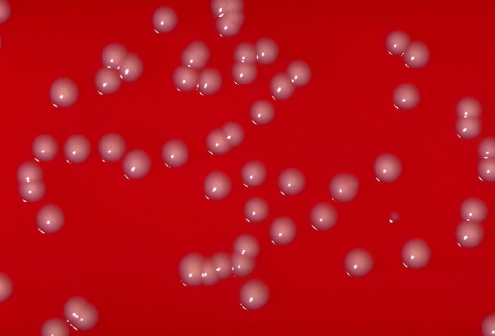 C. ulcerans colonies on a blood agar plate.