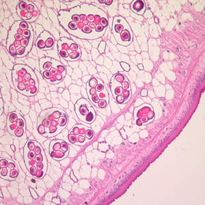 Cross-section of a D. caninum proglottid stained with H&E. Image taken at 100x magnification. Adapted from CDC