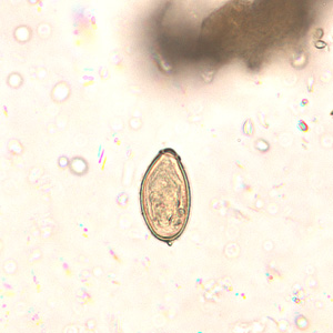 Egg of O. viverrini in an unstained wet mount of concentrated stool. Image taken at 400x magnification. Adapted from CDC