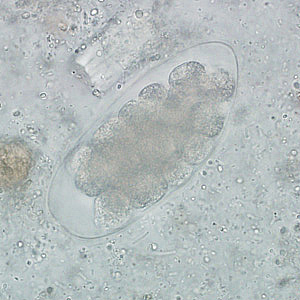 Egg of Trichostrongylus sp. in an unstained wet mount of stool. Image courtesy of the Indiana State Department of Health. Adapted from CDC