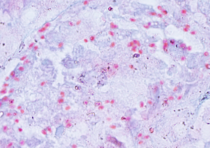 Spores of E. cuniculi in a kidney biopsy specimen stained with Ryan's modified trichrome. Adapted from CDC