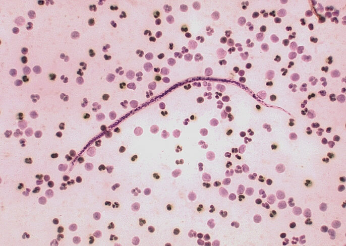 Loa loai, agent of filariasis. Anterior end. Parasite. From Public Health Image Library (PHIL). [3]