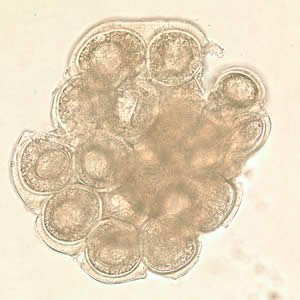 D. caninum egg packet in wet mount. Adapted from CDC