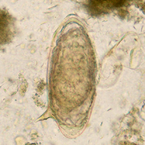 Egg of S. mansoni in an unstained wet mount. Adapted from CDC