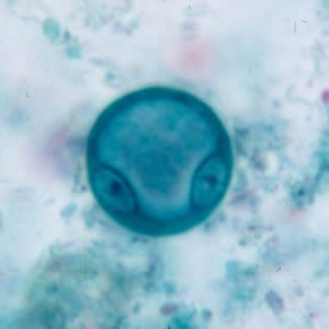 Mature cyst of E. coli, stained with trichrome. This figure and Figure 5 represent the same cyst shown in two different focal planes. Eight nuclei can be seen between the two focal planes. Adapted from CDC