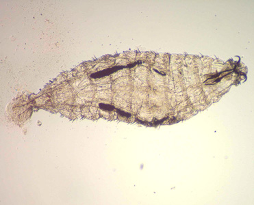 First instar larva of O. ovis, collected from the eye of a patient in India presenting with conjunctivitis. Image courtesy of the L V Prasad Eye Institute, Banjara Hills, India. Adapted from CDC