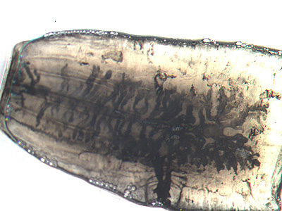 Mature proglottid of T. saginata, stained with India ink. Note the number of primary uterine branches (>12). Image courtesy of the Orange County Public Health Laboratory, Santa Ana, CA. Adapted from CDC