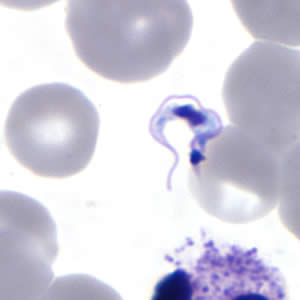 T. cruzi trypomastigote in a thin blood smear stained with Giemsa. Adapted from CDC