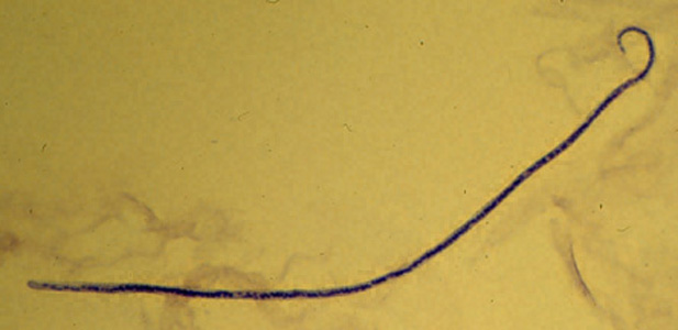 Microfilaria of M. streptocerca, fixed in 2% formalin and stained with hematoxylin. Adapted from CDC