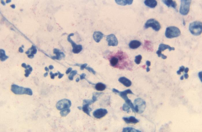 Gram-negative Chlamydophila psittaci bacteria. From Public Health Image Library (PHIL). [1]