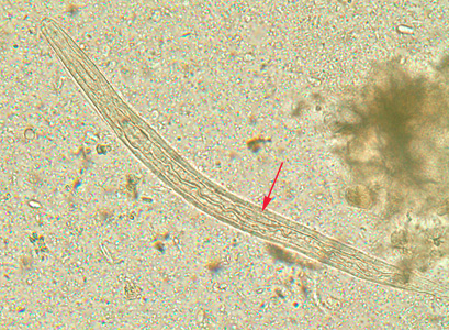 Rhabditiform larva of S. stercoralis in an unstained wet mount of stool. Notice the prominent genital primordium (blue arrow), rhabditoid esophagus (red arrow) and short buccal canal (green arrow). Adapted from CDC